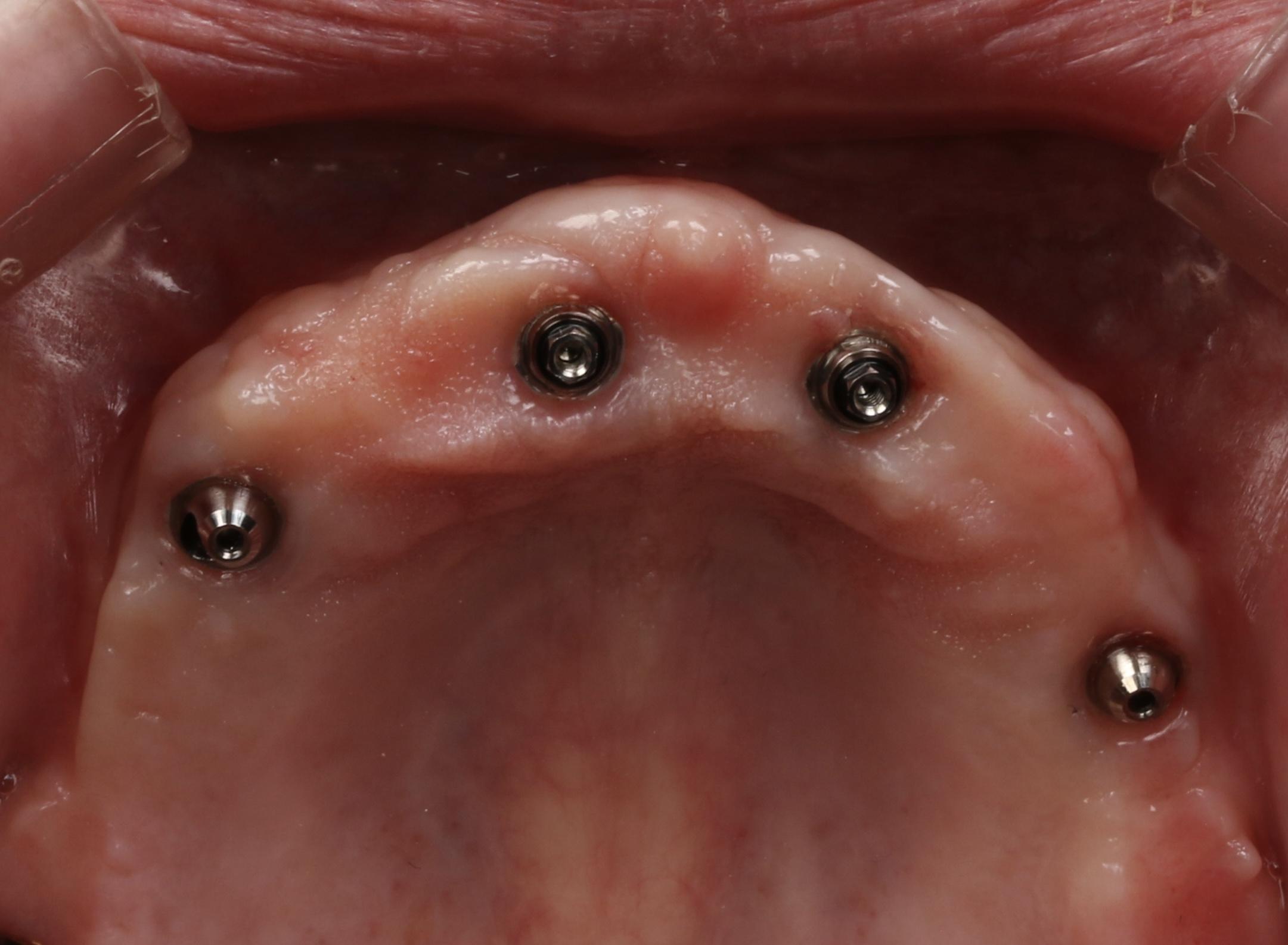 Клинический случай 2