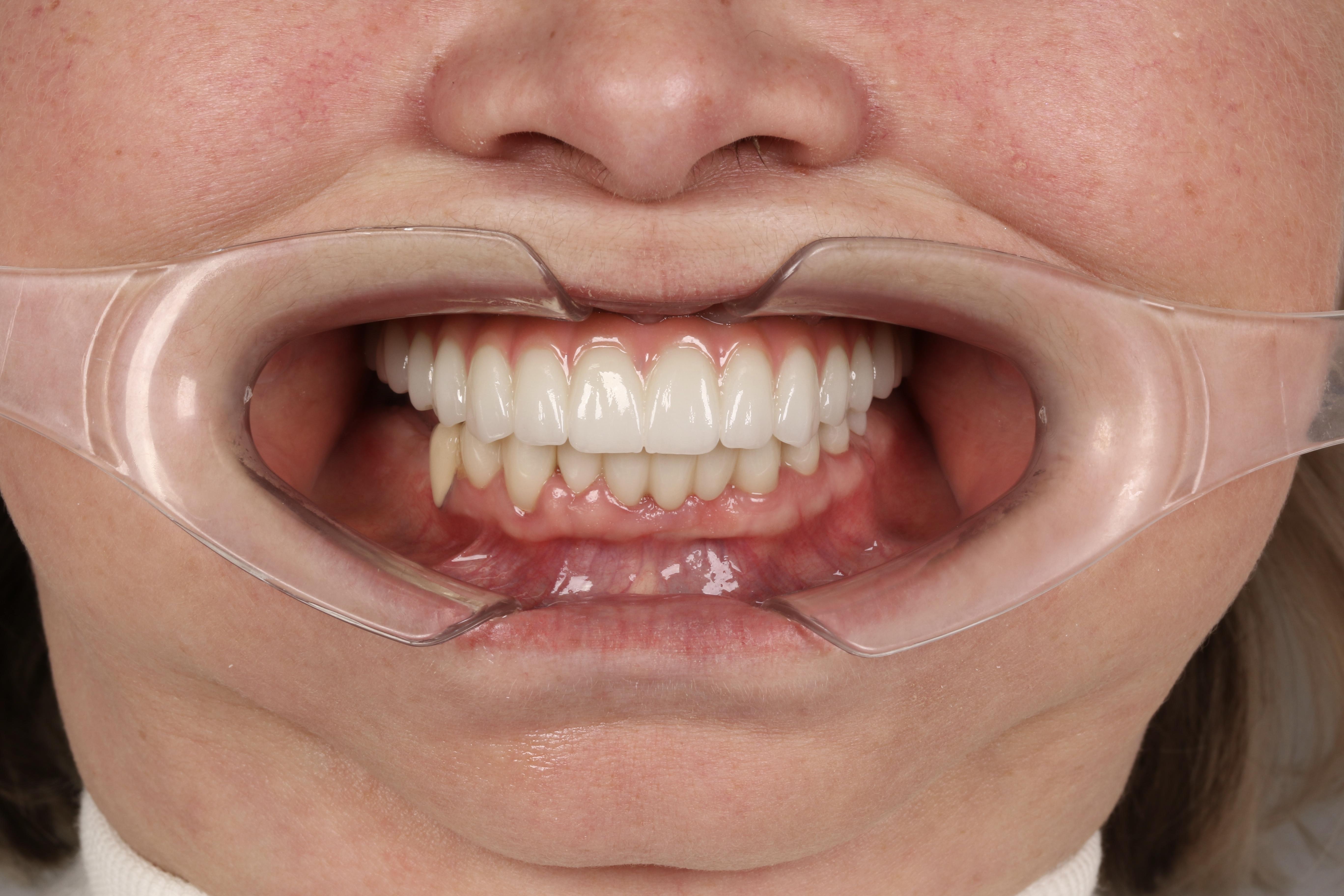 Клинический случай 1