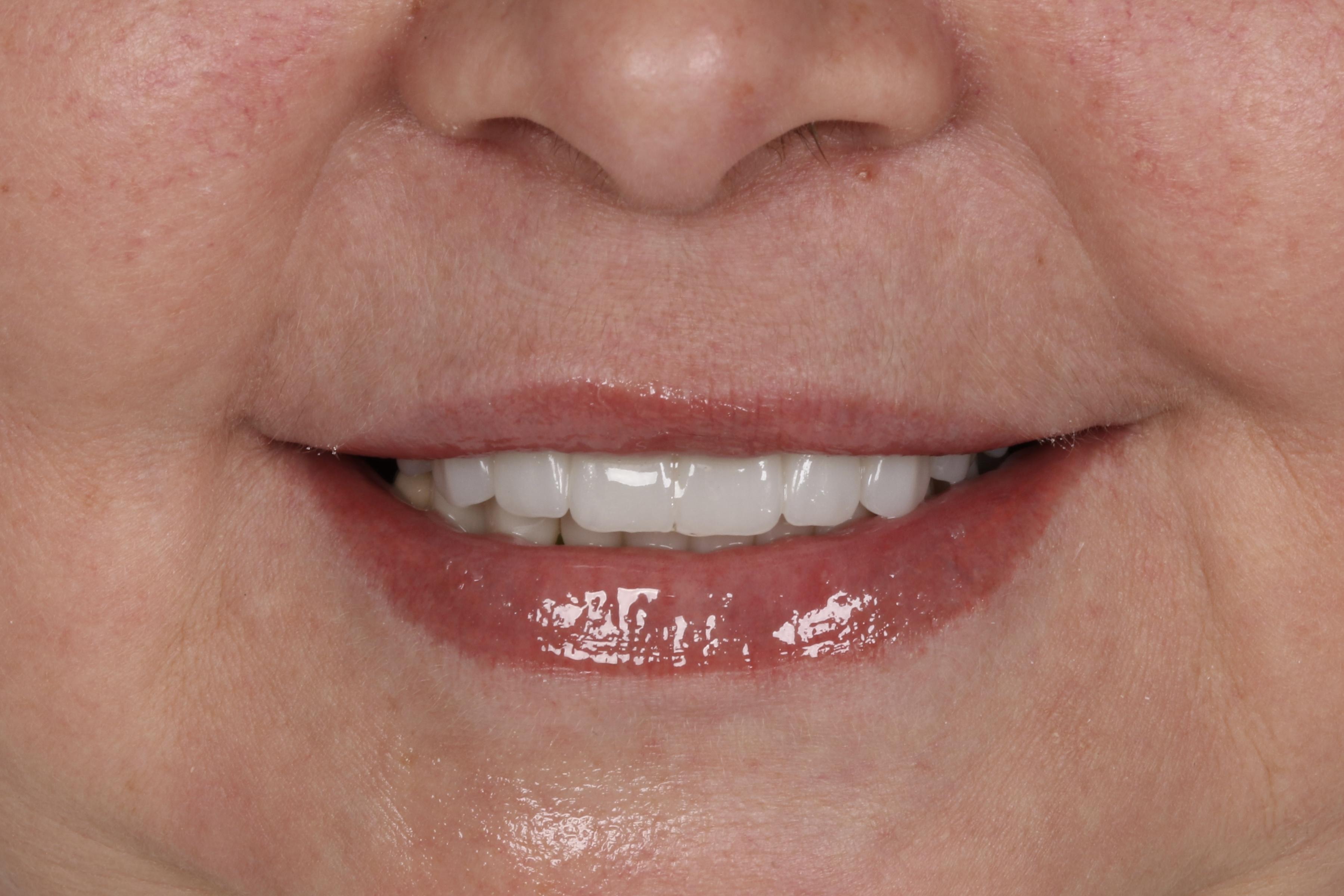 Клинический случай 4