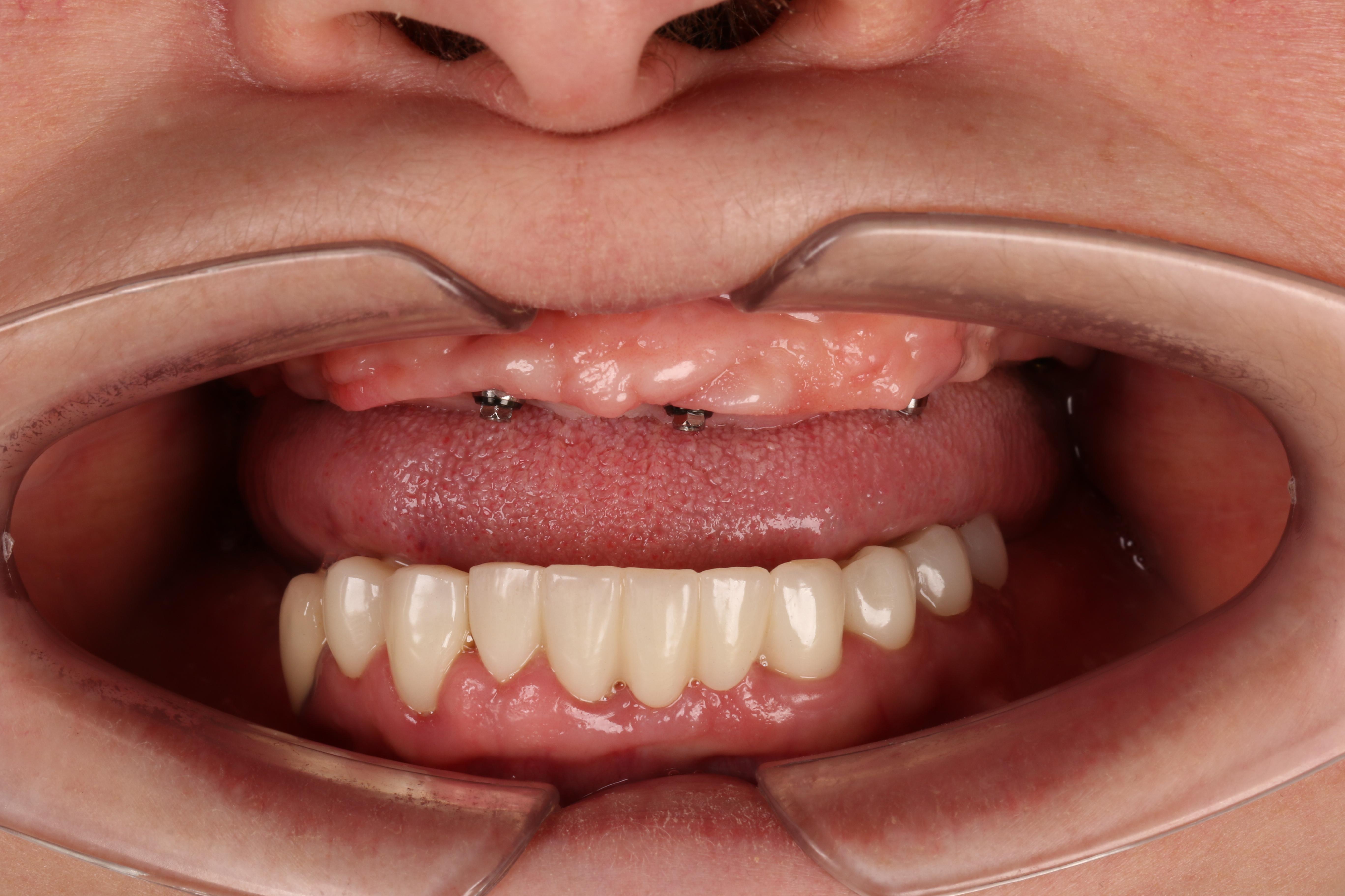 Клинический случай 3